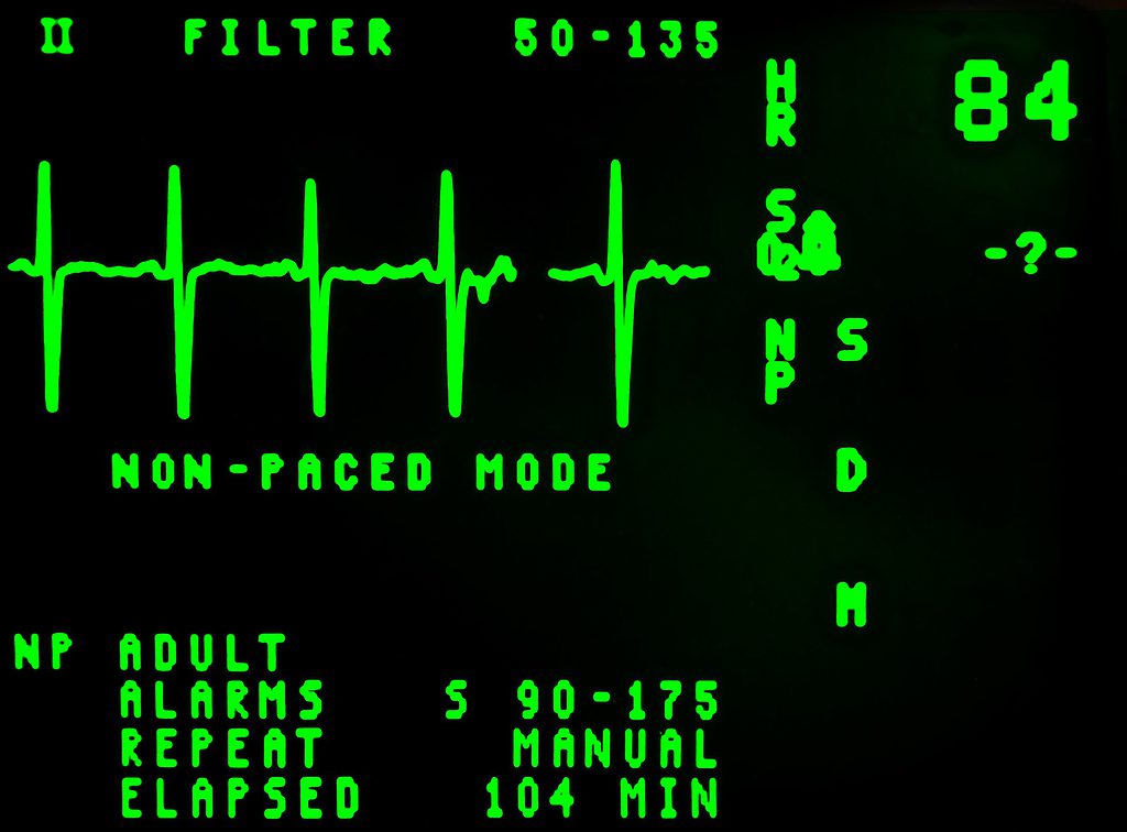 Electrocardiogram