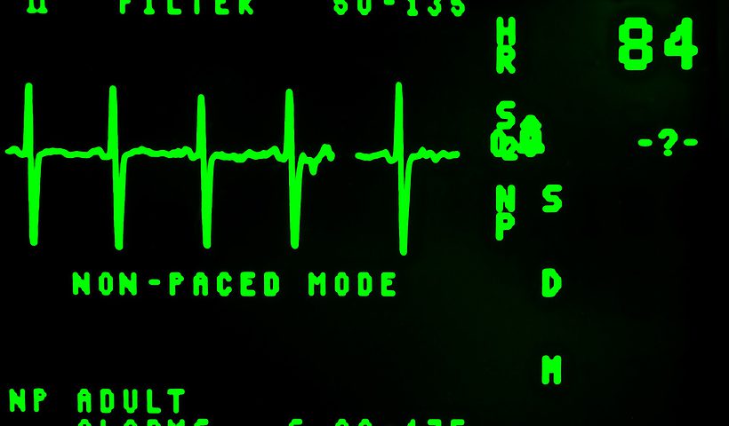 Electrocardiogram