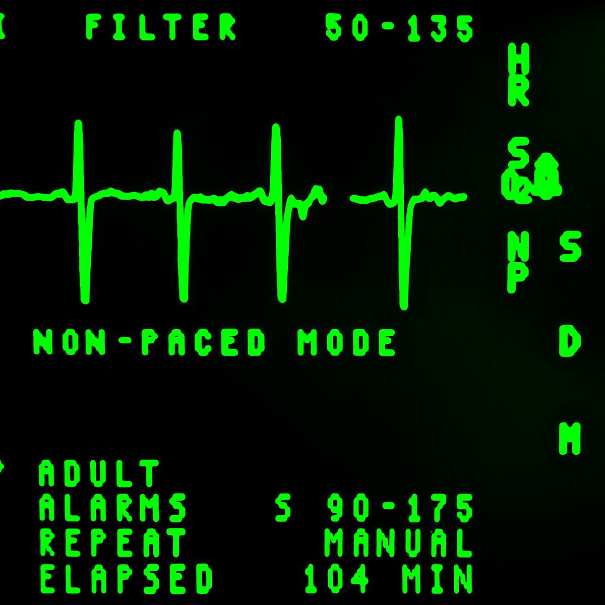Electrocardiogram