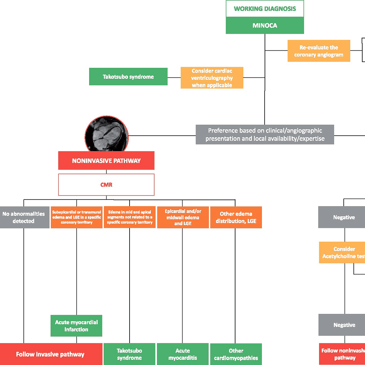 Diagnostic pathways for myocardial infarction