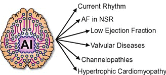 Application of artificial intelligence to the electrocardiogram